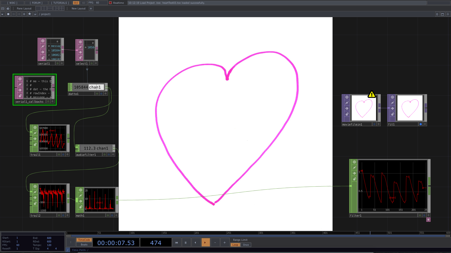 Electrocardiogram Using Touchdesigner Arduino Homemadegarbage